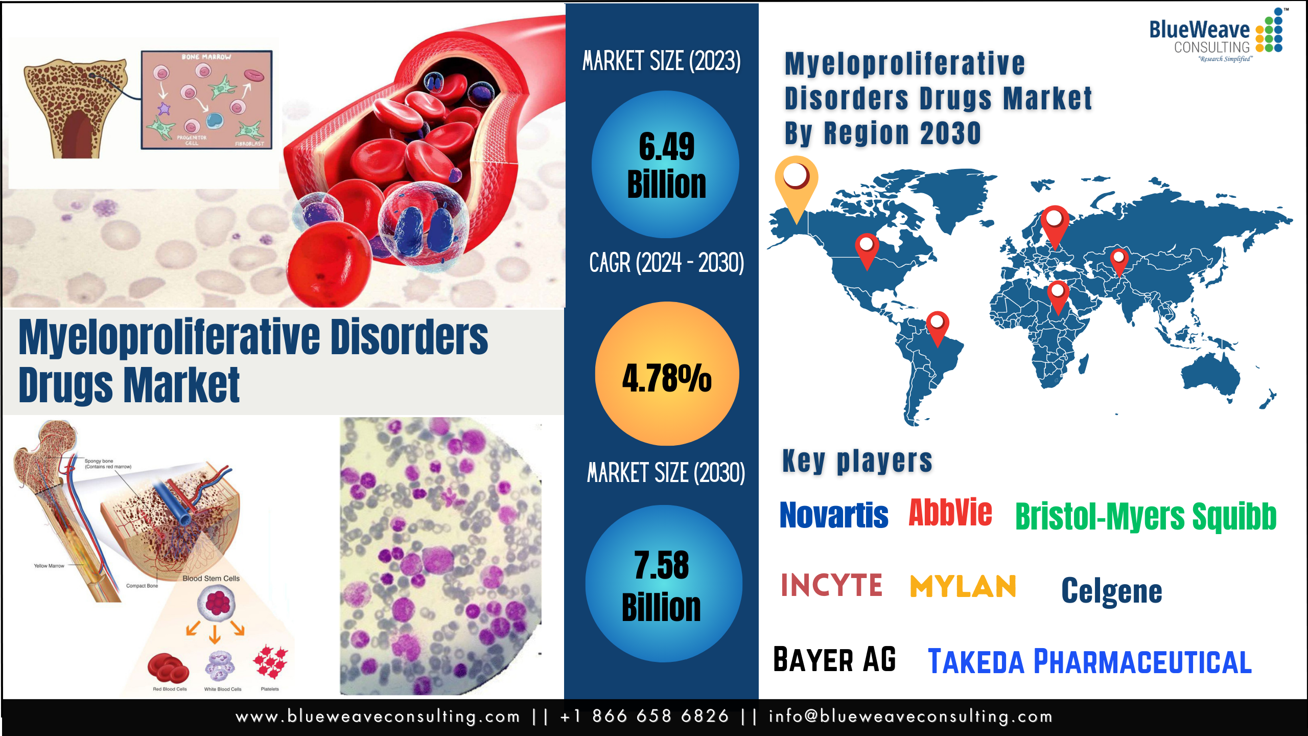Myeloproliferative Disorders Drugs Market